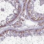 Anti-PSMD11 Antibody