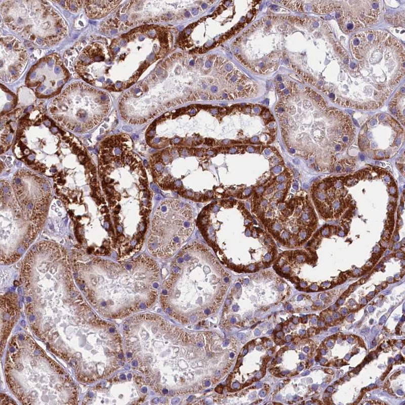 Anti-IL20RA Antibody