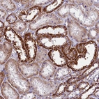 Anti-IL20RA Antibody