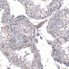 Immunohistochemical staining of human testis shows moderate nuclear positivity in a subset of cells in seminiferous ducts.
