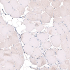 Immunohistochemical staining of human skeletal muscle shows no positivity in striated muscle fibers as expected.