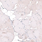 Immunohistochemical staining of human skeletal muscle shows no positivity in striated muscle fibers as expected.