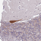 Immunohistochemical staining of human cerebellum shows moderate cytoplasmic positivity in Purkinje cells.