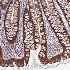 Immunohistochemical staining of human colon shows moderate cytoplasmic positivity in glandular cells.