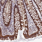 Immunohistochemical staining of human colon shows moderate cytoplasmic positivity in glandular cells.