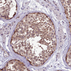 Immunohistochemical staining of human testis shows moderate cytoplasmic positivity in cells in seminiferous ducts.