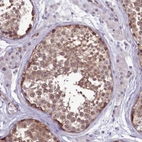 Immunohistochemical staining of human testis shows moderate cytoplasmic positivity in cells in seminiferous ducts.
