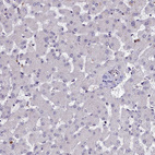 Immunohistochemical staining of human liver shows very weak cytoplasmic positivity in hepatocytes.