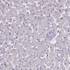 Immunohistochemical staining of human liver shows very weak cytoplasmic positivity in hepatocytes.