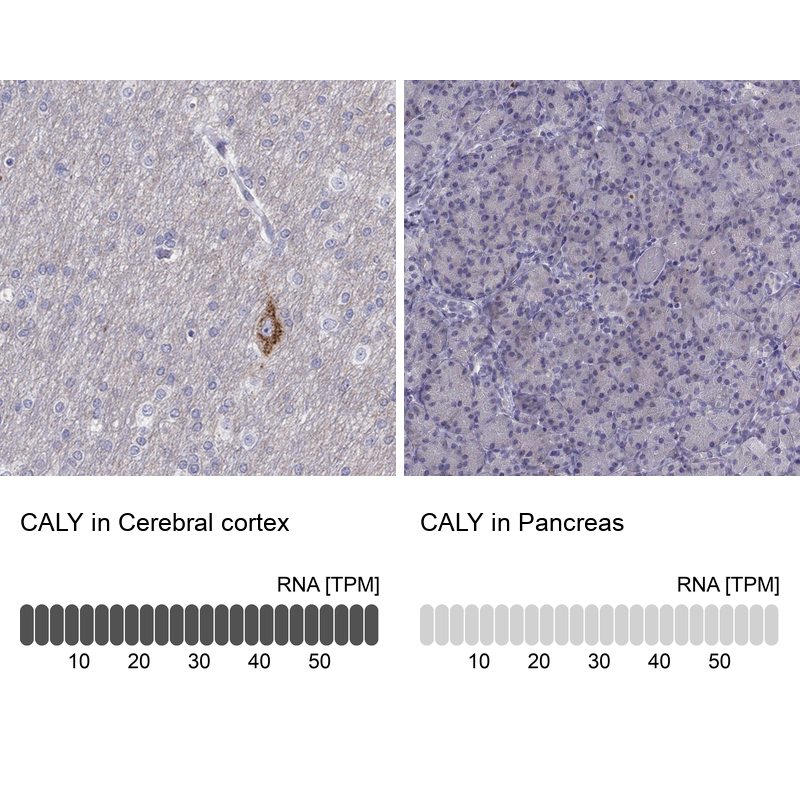 Anti-CALY Antibody