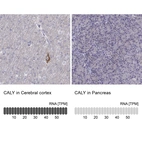 Anti-CALY Antibody