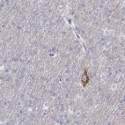 Immunohistochemical staining of human cerebral cortex shows high expression.