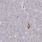Immunohistochemical staining of human cerebral cortex shows high expression.