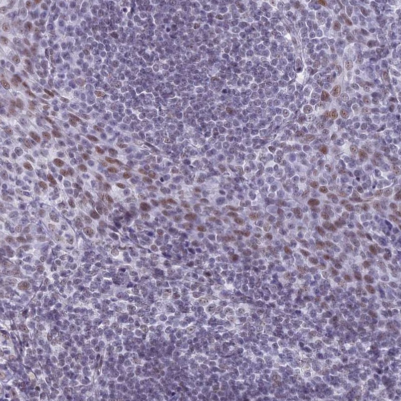 Anti-ASH2L Antibody