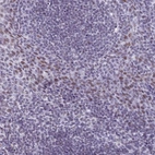 Anti-ASH2L Antibody