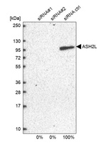 Western blot analysis in U2OS cells transfected with control siRNA, target specific siRNA probe #1 and #2, using Anti-ASH2L antibody. Remaining relative intensity is presented.