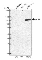 Anti-ASH2L Antibody