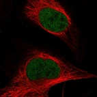 Immunofluorescent staining of human cell line U-2 OS shows localization to nucleoplasm.