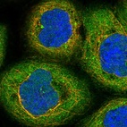 Immunofluorescent staining of human cell line A-431 shows localization to cytosol & microtubules.