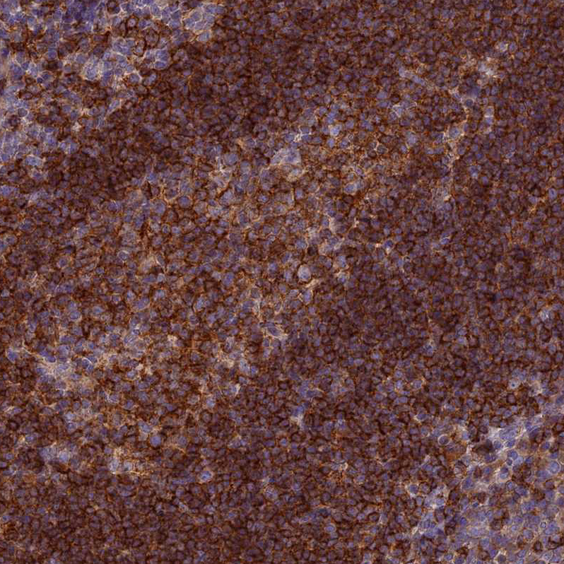 Anti-EDAR Antibody