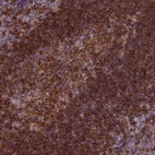 Anti-EDAR Antibody