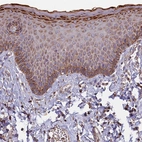 Immunohistochemical staining of human skin shows moderate cytoplasmic granular positivity in squamous epithelial cells.