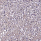 Immunohistochemical staining of human liver shows no positivity in human liver as expected.