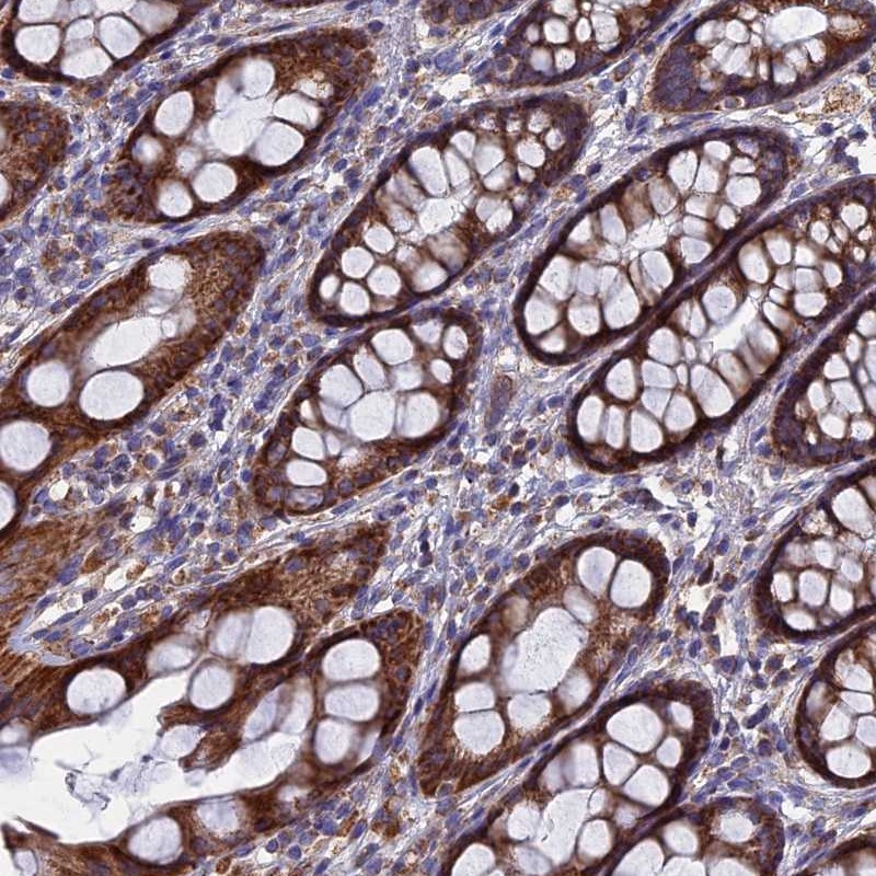 Anti-TGFA Antibody
