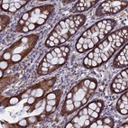 Anti-TGFA Antibody