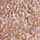 Anti-ACAA2 Antibody