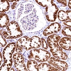 Immunohistochemical staining of human kidney shows strong granular cytoplasmic positivity in cells in tubules.