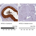 Anti-WFDC2 Antibody