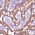 Immunohistochemical staining of human duodenum shows strong granular cytoplasmic positivity in glandular cells.