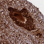 Immunohistochemical staining of human cervix, uterine shows strong cytoplasmic positivity in glandular cells.