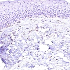 Immunohistochemical staining of human cervix shows no positivity in squamous epithelial cells as expected.