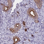 Immunohistochemical staining of human salivary gland shows strong cytoplasmic positivity in interlobular ducts.