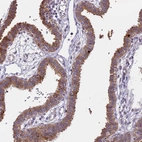 Immunohistochemical staining of human fallopian tube shows moderate cytoplasmic positivity in glandular cells.