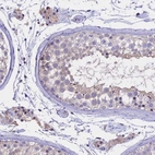 Immunohistochemical staining of human testis shows weak cytoplasmic positivity in cells in seminiferous ducts as expected.