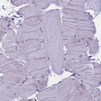 Immunohistochemical staining of human skeletal muscle shows no positivity as expected.