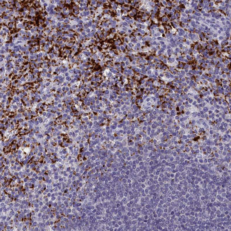 Anti-AIFM2 Antibody