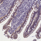 Immunohistochemical staining of human small intestine shows weak cytoplasmic and membranous positivity in glandular cells.