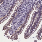 Immunohistochemical staining of human small intestine shows weak cytoplasmic and membranous positivity in glandular cells.
