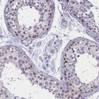 Immunohistochemical staining of human testis shows weak cytoplasmic and nuclear positivity in a subset of cells in seminiferous ducts.
