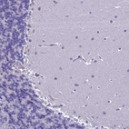 Immunohistochemical staining of human cerebellum shows no positivity in cells in molecular layer as expected.