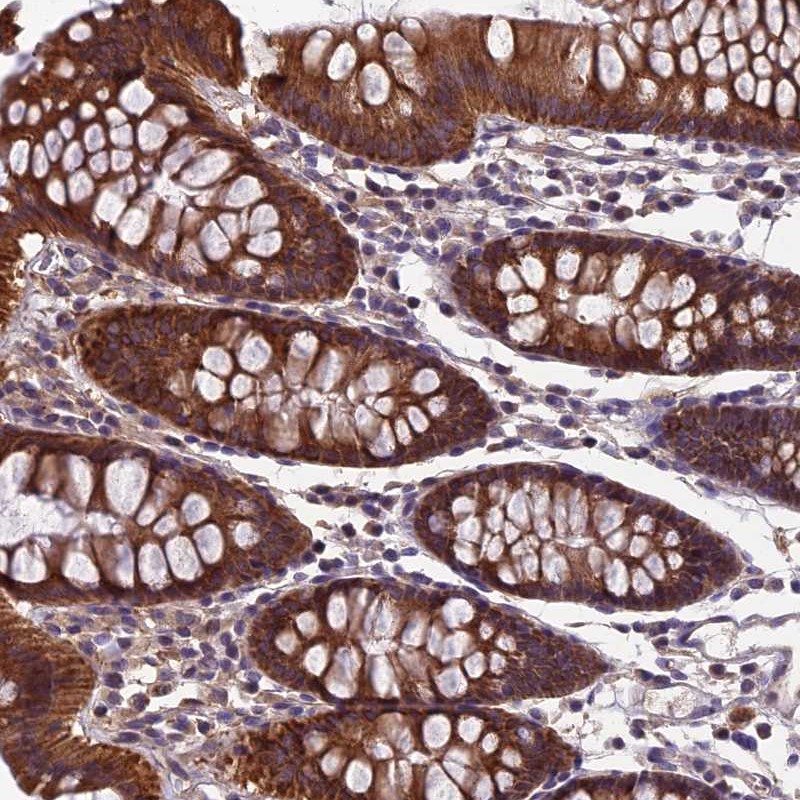 Anti-HECA Antibody