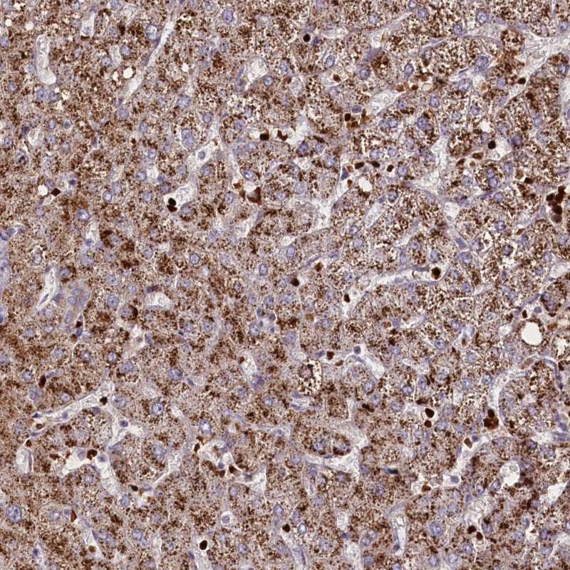 Anti-SUSD3 Antibody