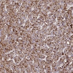 Anti-SUSD3 Antibody