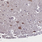 Anti-ABCC8 Antibody