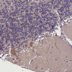 Immunohistochemical staining of human cerebellum shows strong cytoplasmic positivity in purkinje cells.