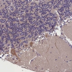 Immunohistochemical staining of human cerebellum shows strong cytoplasmic positivity in purkinje cells.